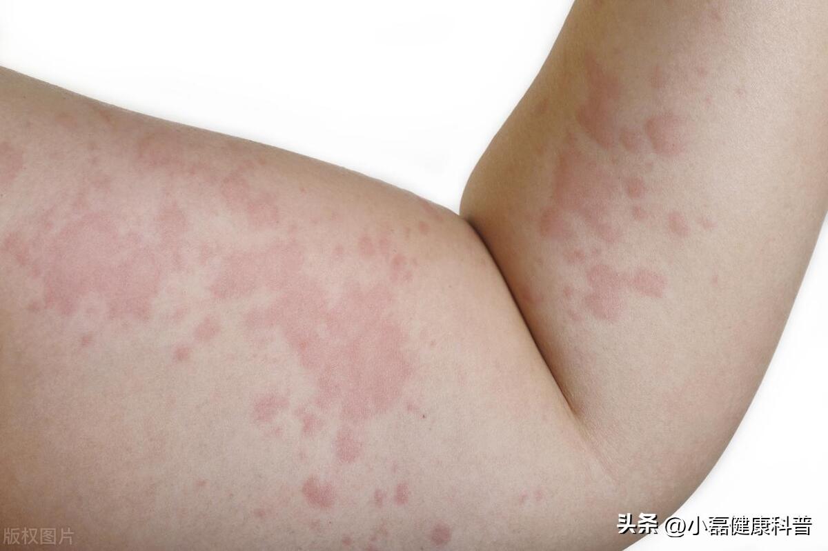 養生吃什么堅果好_吃堅果養生嗎_養生堅果吃好還是吃好